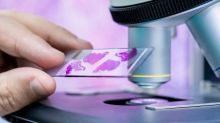 Ministerstvo chce omezit screening rakoviny čípku, má skončit preventivní cytologie mladých žen
