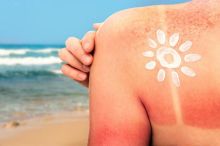 Dermatolog varuje: Jarní slunce je pro kůži šok. Většina lidí se maže špatně a riskuje zdraví i vrásky