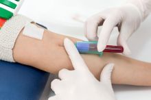 Lidí, kteří darují, krev ubývá. Nemocnice kvůli věku musí vyřazovat starší dárce