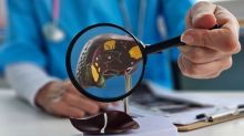 Lékaři zájemcům zdarma zkontrolují játra. Vyšetření je rychlé a bezbolestné